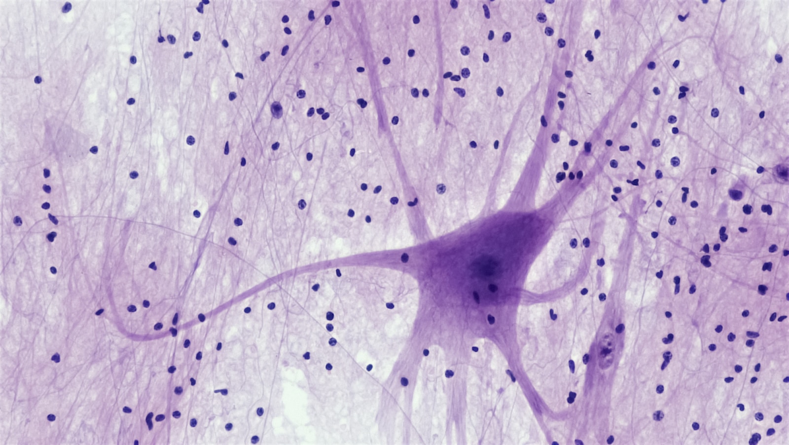 Photo by Bioscience Image Library by Fayette Reynolds Nervous Tissue: Spinal Cord Motor Neuron